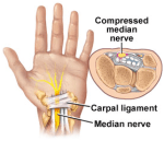 cts-carpal-tunnel